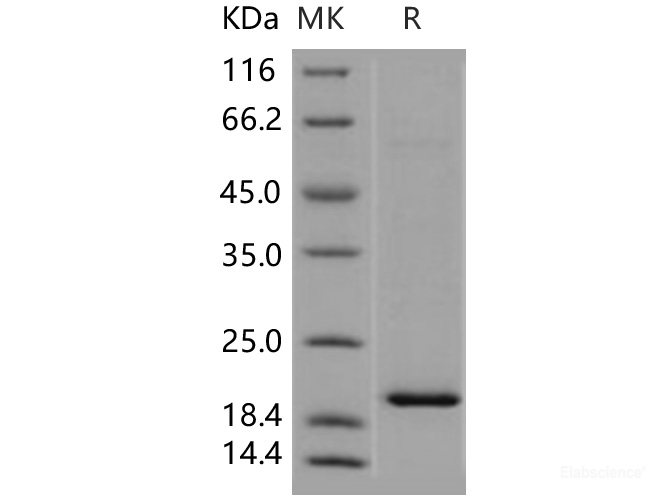 Recombinant Human TSC22D1 Protein (His tag)-Elabscience