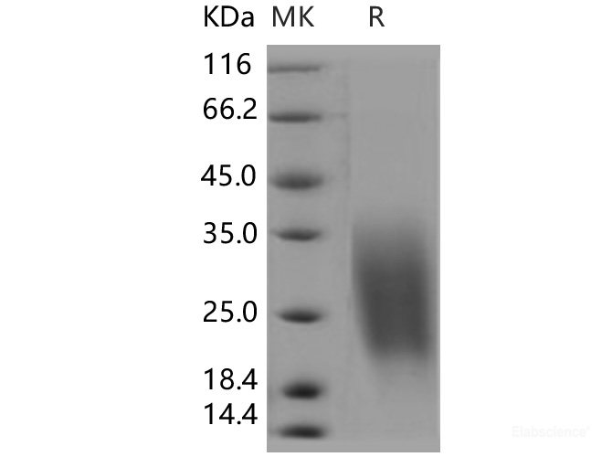 Recombinant Human CREB3L1 / OASIS Protein (aa 396-519, His tag)-Elabscience