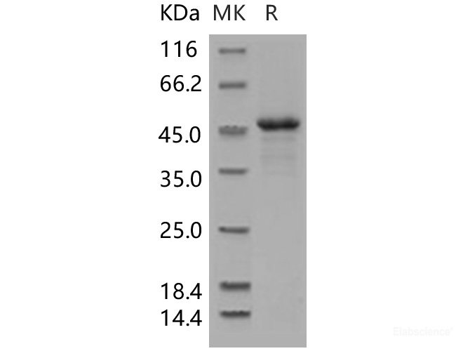 Recombinant Human ILKAP Protein (His tag)-Elabscience