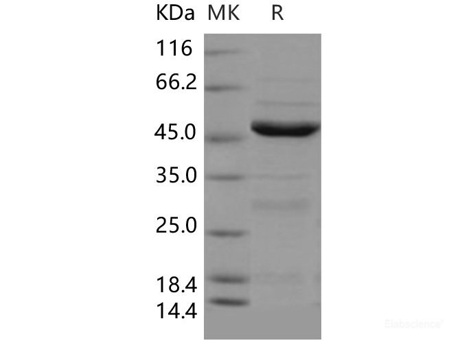 Recombinant Human NEIL1 Protein (His tag)-Elabscience