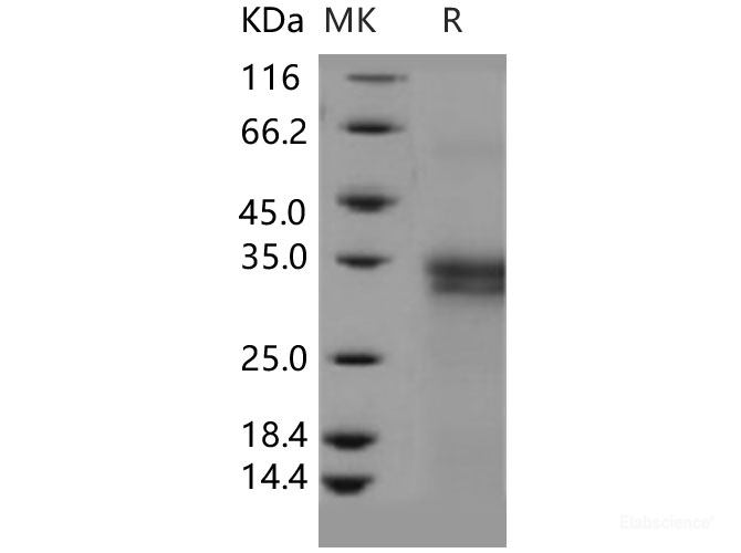 Recombinant Human IFI30 Protein (His tag)-Elabscience