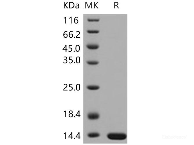 Recombinant Human LAMTOR2 / ROBLD3 / MAPBPIP Protein (His tag)-Elabscience