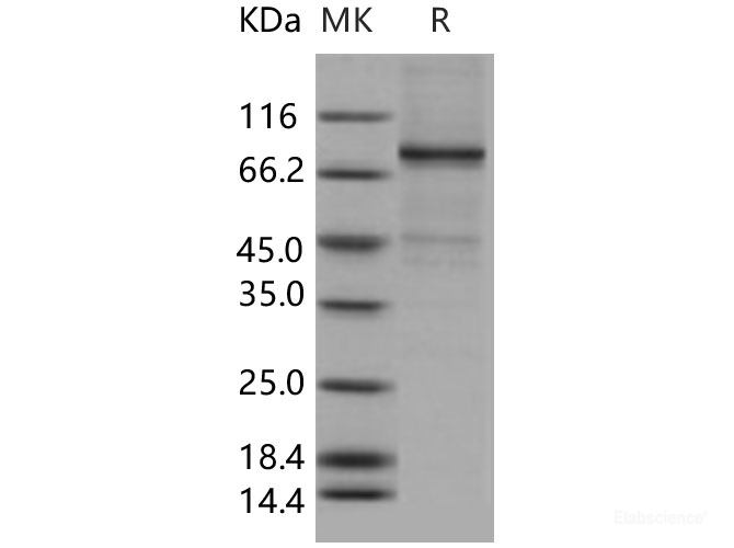 Recombinant Human ELK1 Protein (His & GST tag)-Elabscience
