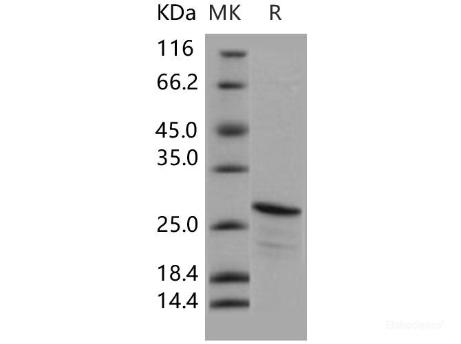 Recombinant Human CIB2 / KIP-2 Protein (His tag)-Elabscience