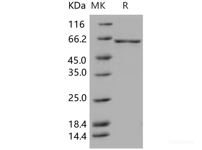 Recombinant Human GAD67 / GAD1 Protein (His tag)-Elabscience