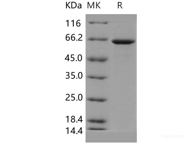 Recombinant Human GBP1 Protein (His tag)-Elabscience