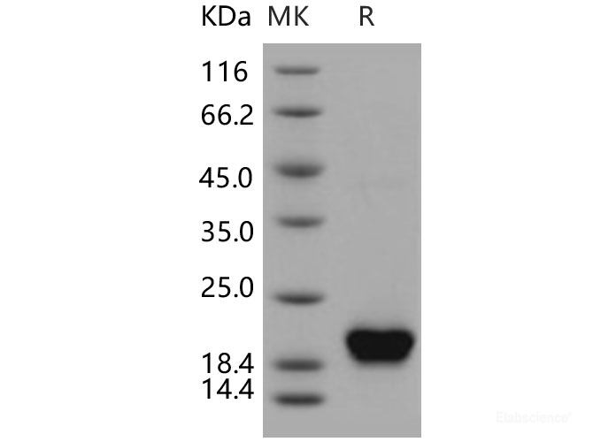 Recombinant Human NUDT2 / Ap4A hydrolase Protein (His tag)-Elabscience