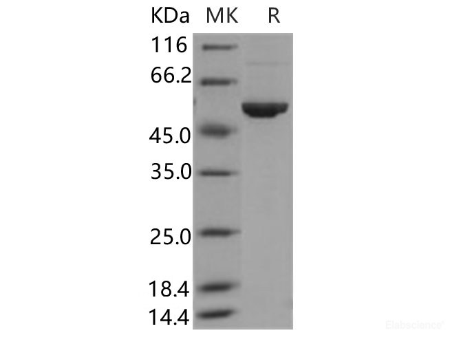 Recombinant Human ALDH3A1 Protein (His Tag)-Elabscience