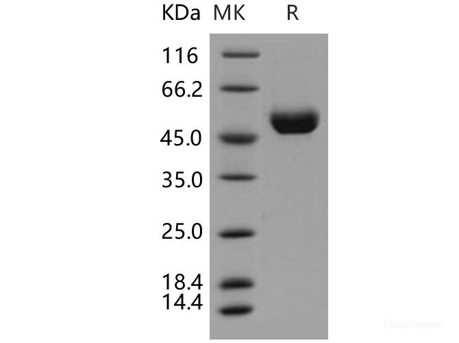 Recombinant Human Cathepsin D / CTSD Protein (His tag)-Elabscience