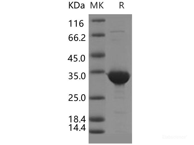 Recombinant Human BVES / POPDC1 Protein (GST tag)-Elabscience