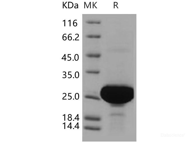 Recombinant Human PARK7 / DJ-1 Protein (His tag)-Elabscience