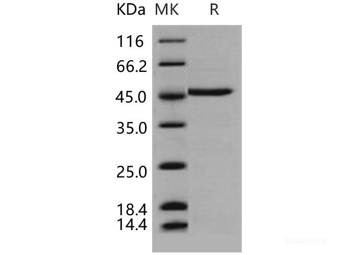 Recombinant Human DDOST / OST48 Protein-Elabscience