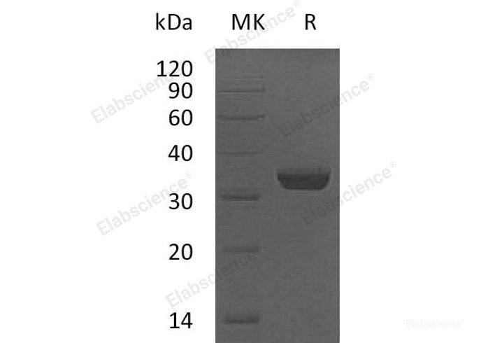 Recombinant Human LMAN2 Protein (His Tag)-Elabscience