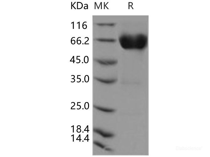 Recombinant Human CD300A Protein (Fc tag)-Elabscience
