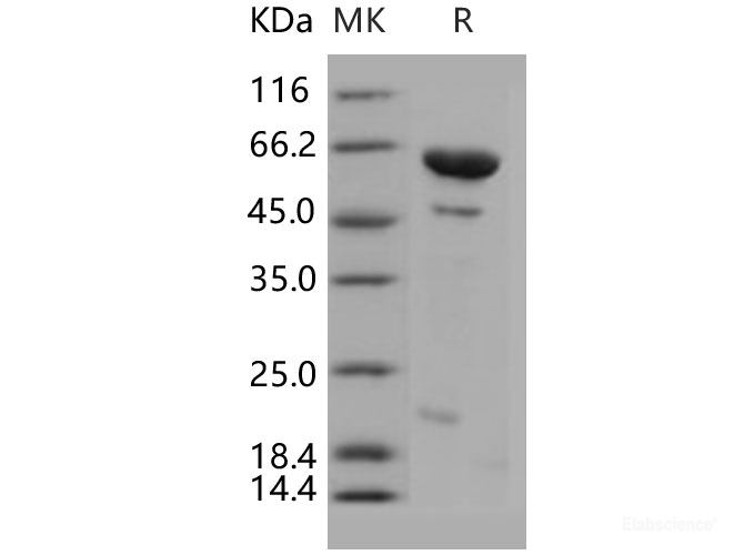 Recombinant Human DUSP14 / MKP-6 Protein (His & MBP tag)-Elabscience