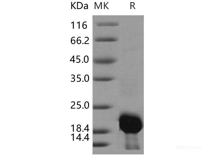 Recombinant Human Calmodulin 2 / CALM2 Protein (His tag)-Elabscience