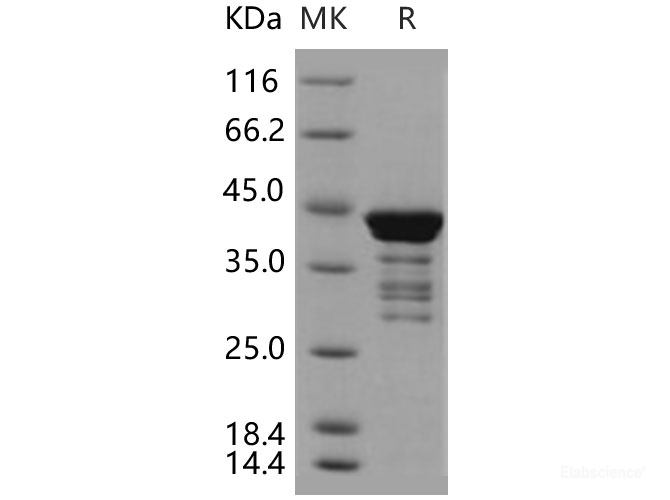 Recombinant Human C1D Protein (GST tag)-Elabscience