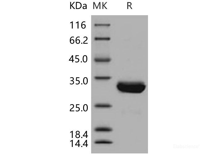 Recombinant Human SCGN / Secretagogin Protein (His tag)-Elabscience