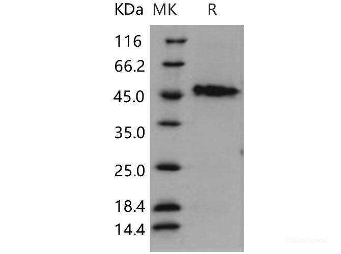 Recombinant Human GAP43 / Neuromodulin Protein (His tag)-Elabscience