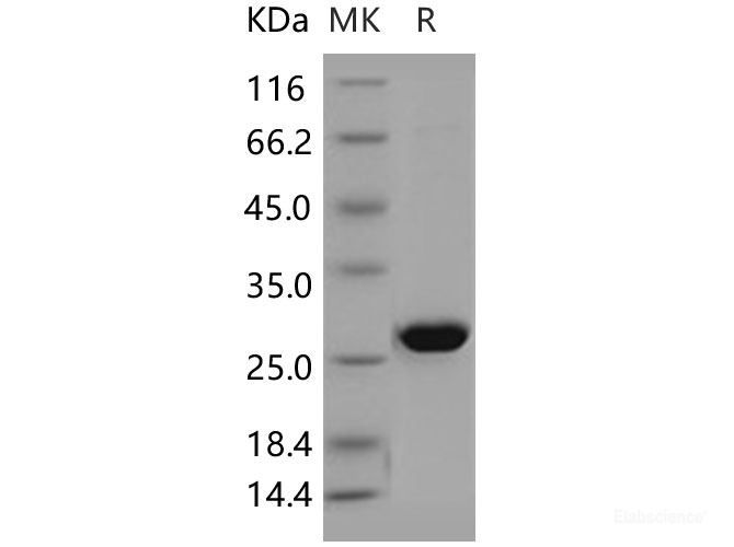 Recombinant Human AK4 / Adenylate Kinase 4 / AK3L1 Protein-Elabscience