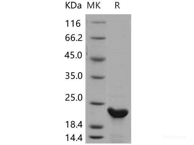 Recombinant Human N6AMT1 / HEMK2 Protein (His tag)-Elabscience