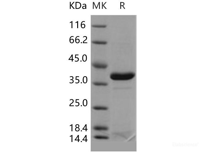 Recombinant Human APEX1 / AP / APEx / Ref-1 Protein (His tag)-Elabscience