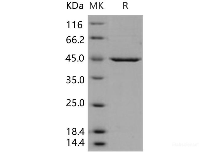 Recombinant Human PDK-1 Protein (His tag)-Elabscience