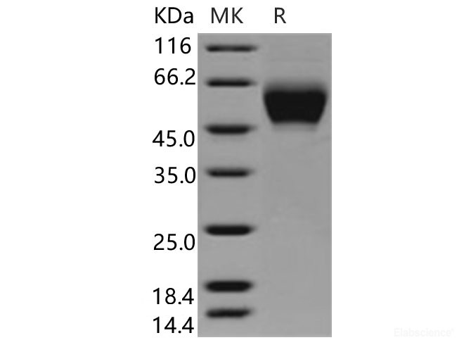 Recombinant Human MICA Protein (His Tag)-Elabscience