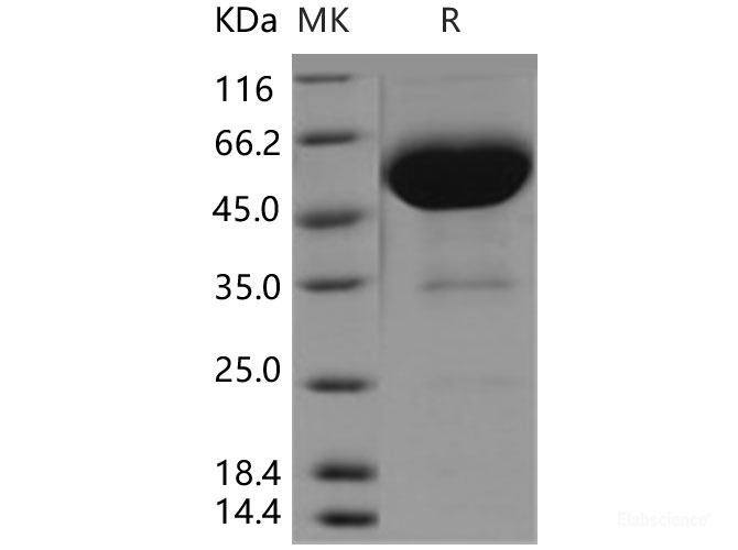 Recombinant Human CD47 Protein (Fc tag)-Elabscience