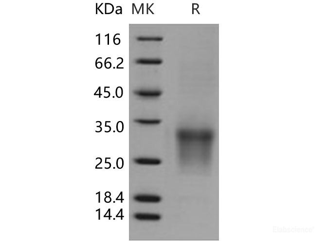 Recombinant Human CD82 / KAI-1 Protein (His tag)-Elabscience