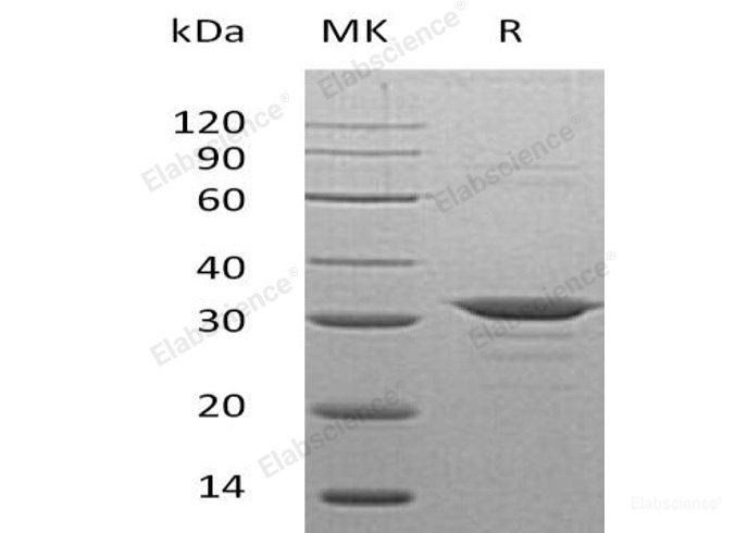 Recombinant Human CLIC4 Protein (His Tag)-Elabscience