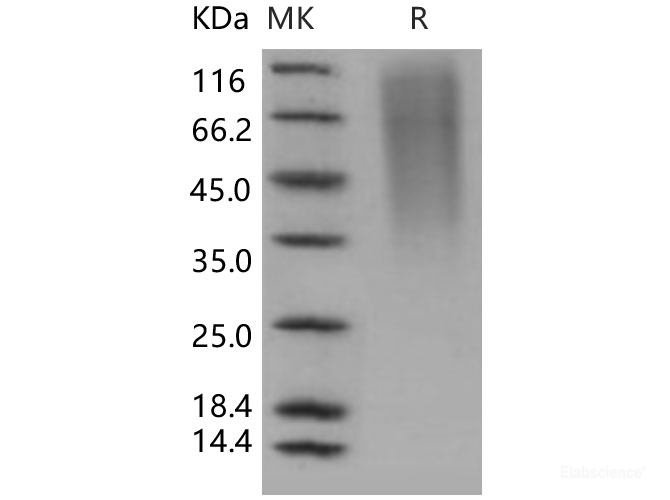Recombinant Human CD164 / Endolyn Protein (His tag)-Elabscience