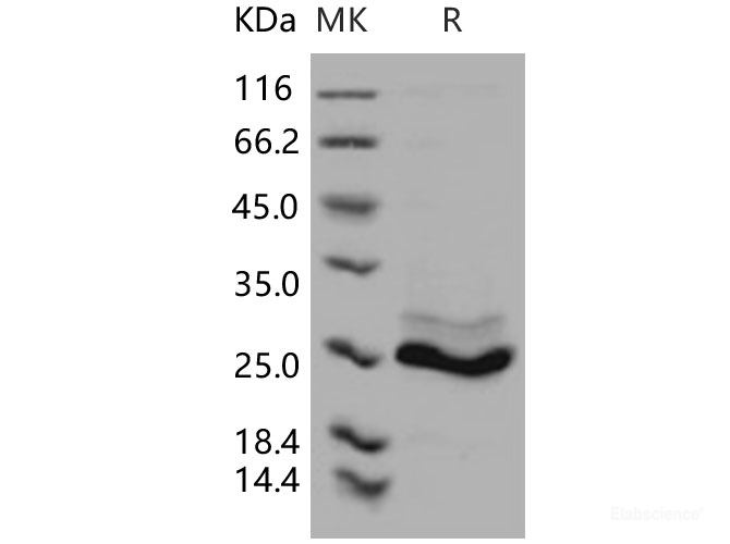 Recombinant Human K-Ras / K-Ras Protein (His tag)-Elabscience