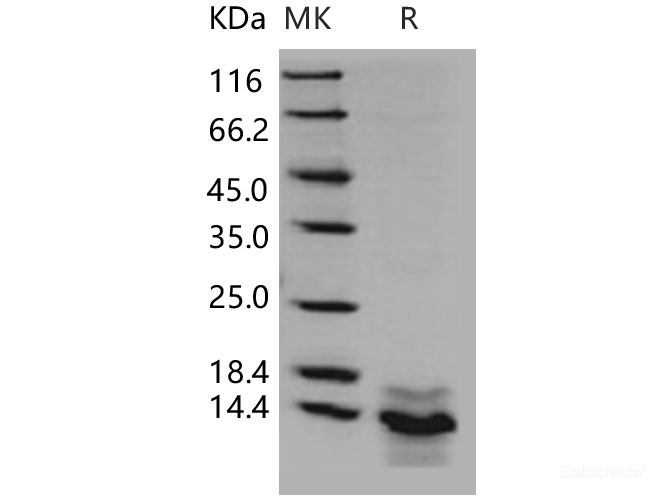 Recombinant Human S100A14 / S114 Protein (His tag)-Elabscience