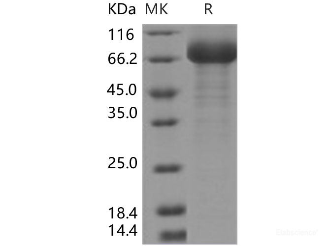 Recombinant Human SIGLEC6 / CD327 Protein (Fc tag)-Elabscience