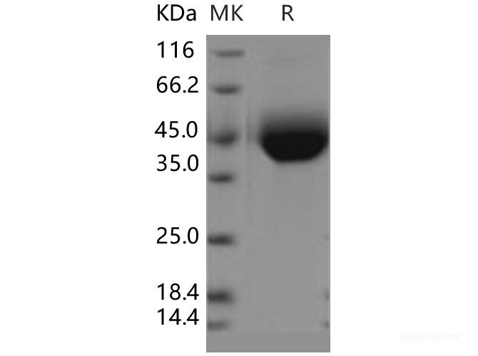 Recombinant Human CD33 / Siglec-3 Protein (His tag)-Elabscience