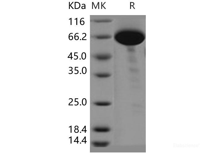 Recombinant Human COL9A1 Protein (Fc tag)-Elabscience