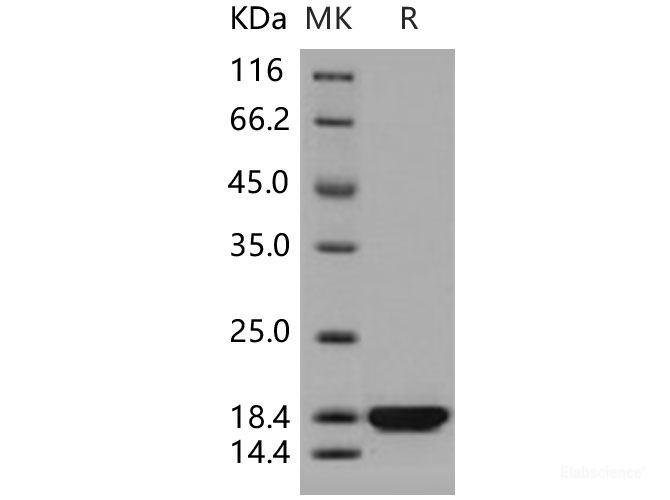 Recombinant Human PDZD11 / PDZK11 / PISP Protein (His tag)-Elabscience