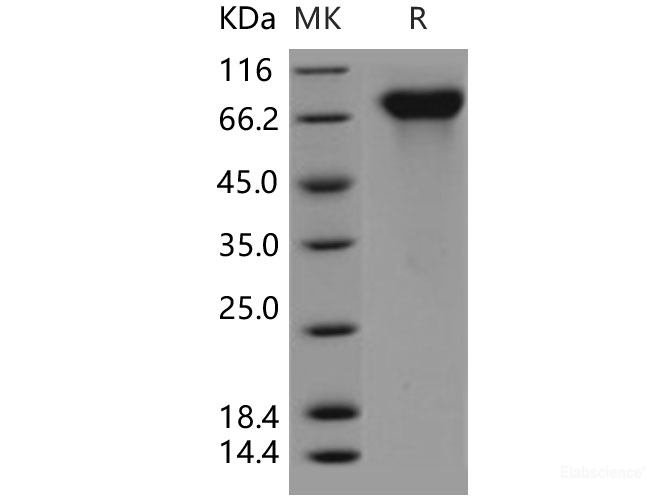 Recombinant Human PROS1 / Protein S Protein (His tag)-Elabscience