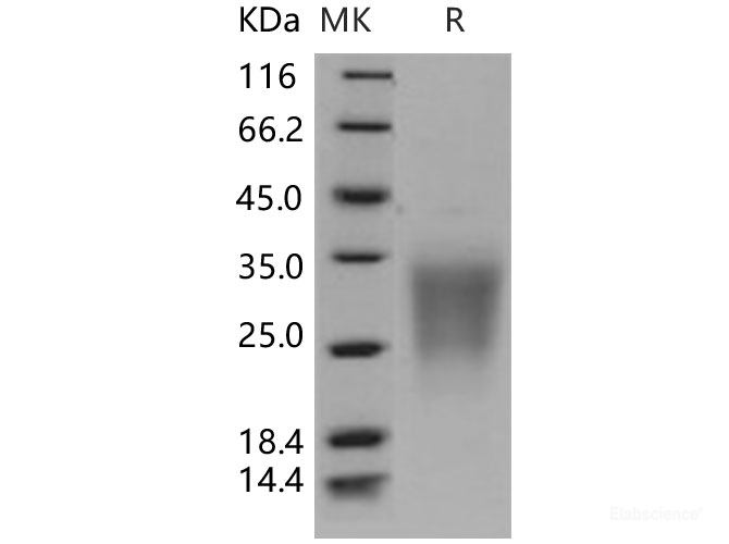 Recombinant Human SIGIRR / TIR8 Protein (His tag)-Elabscience