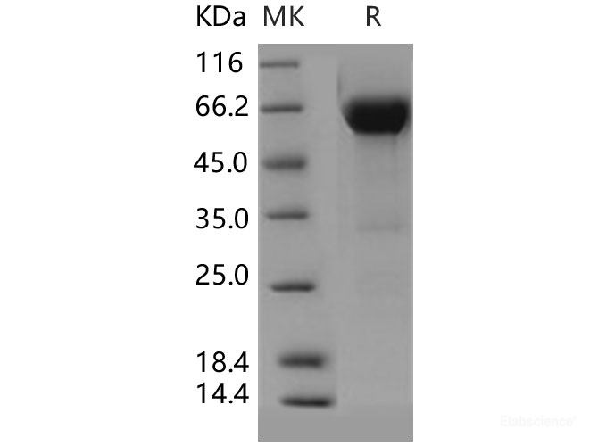 Recombinant Human VSIG4 Protein (Fc tag)-Elabscience
