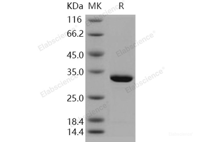 Recombinant Human Carbonic Anhydrase VII / CA7 Protein (His tag)-Elabscience