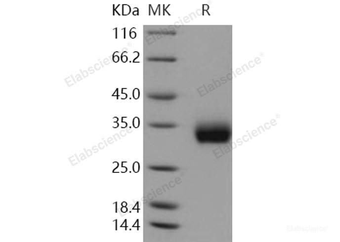 Recombinant Human ULBP2 / N2DL-2 Protein (His tag)-Elabscience
