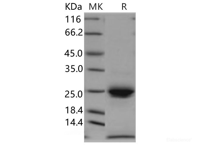 Recombinant Human Kallikrein 6 Protein (His Tag)-Elabscience