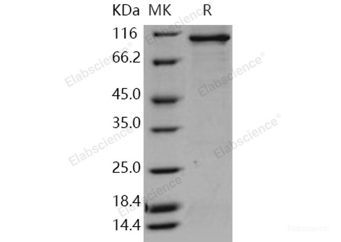 Recombinant Human STK23 / MSSK1 / SRPK3 Protein (His & GST tag)-Elabscience