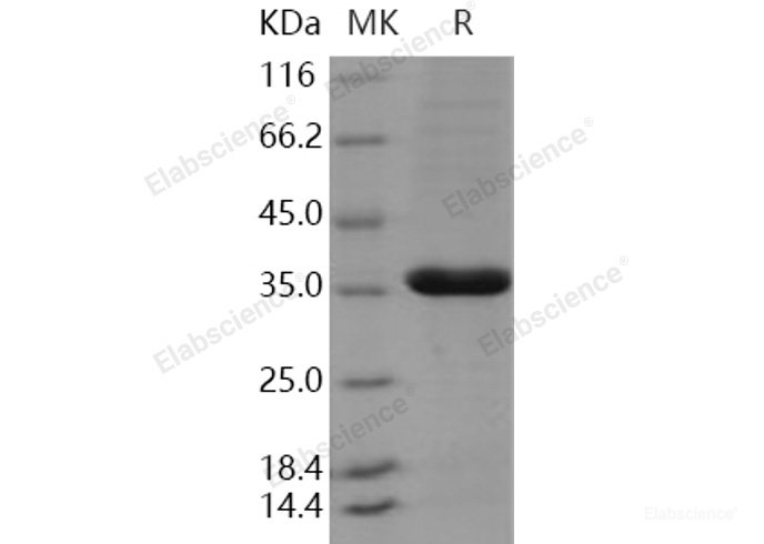 Recombinant Human PCNA Protein (His tag)-Elabscience