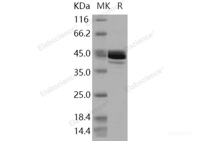 Recombinant Human Fumarate Hydratase / FH Protein (His tag)-Elabscience