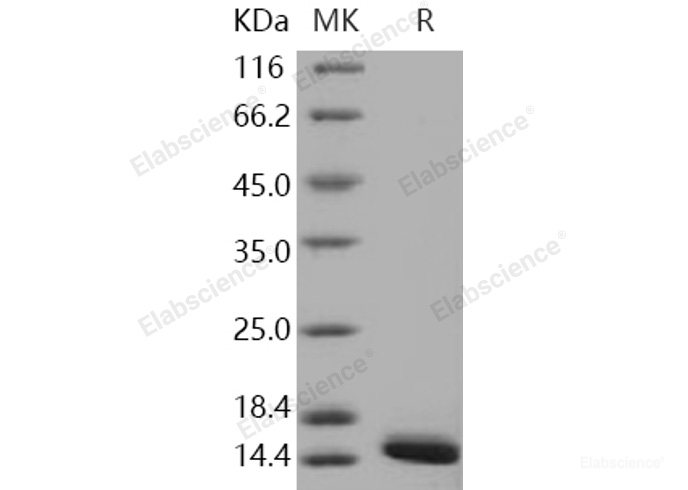 Recombinant Human FABP4 / ALBP / A-FABP Protein (29 Ala/Thr, His tag)-Elabscience