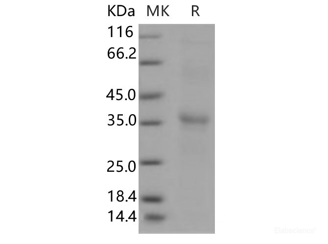 Recombinant Human RGMA Protein (His Tag)-Elabscience