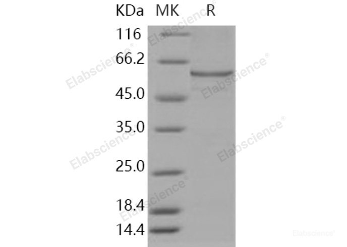 Recombinant Human CAT / Catalase Protein (His tag)-Elabscience